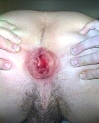 photo-thumb