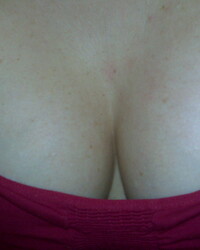 photo-thumb