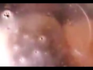 Thumb 9